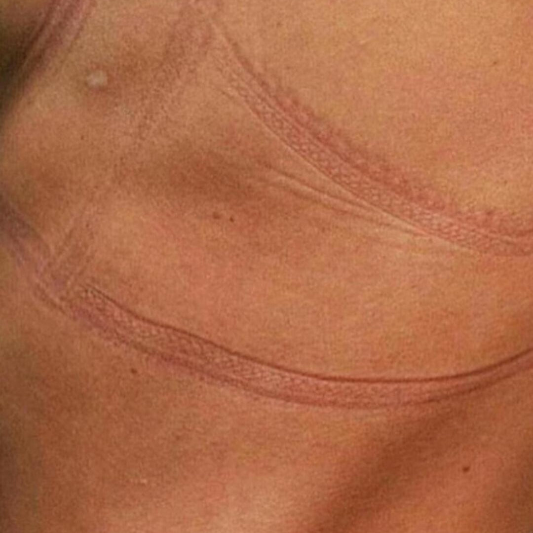 Trouver le soutien-Gorge adapté après une mastectomie : Bahan Paris, les boutiques oncologiques de confiance