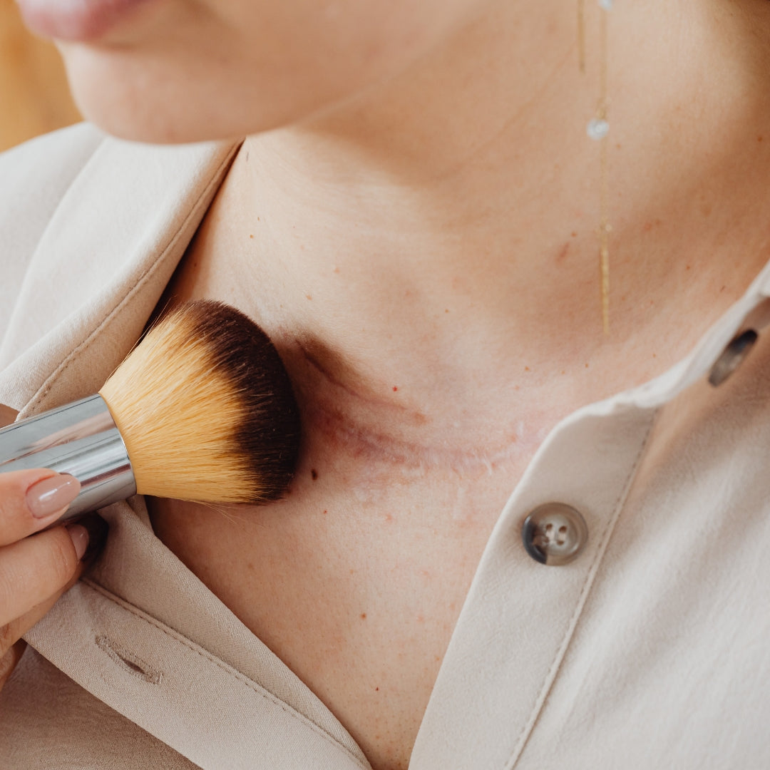 Peut-on maquiller les cicatrices ?
